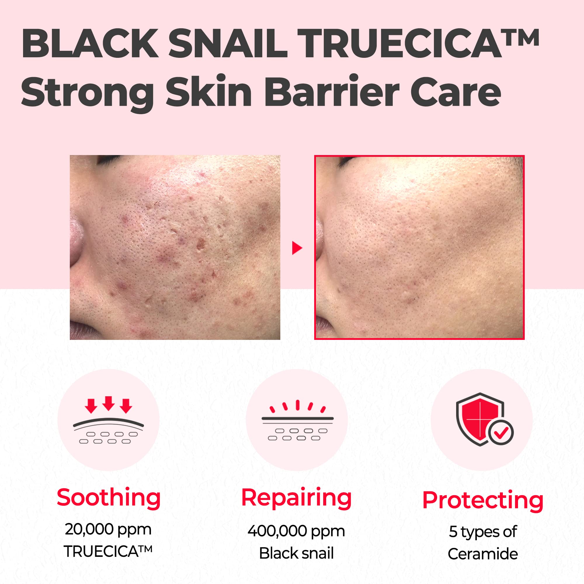 Some By Mi Snail Truecica Miracle Repair Serum