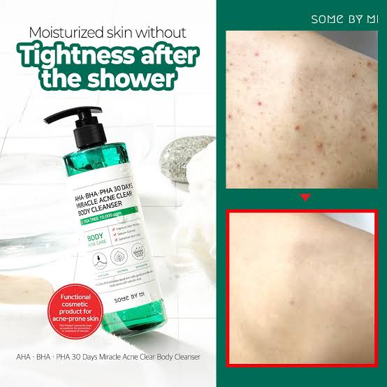 SOME BY MI AHA, BHA, PHA 30 Days Miracle Acne Clear Body Cleanser