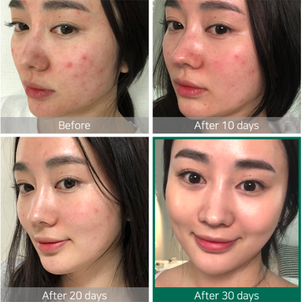 Some By Mi AHA-BHA-PHA 30 Days Miracle Toner 150ml